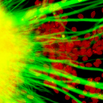 Nerve Signaling