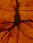Tailored Nerve Transmissions